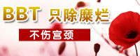 宫颈糜烂治疗